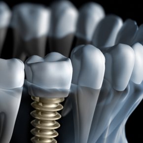Dental 3D Logo